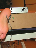 Needles in Feet